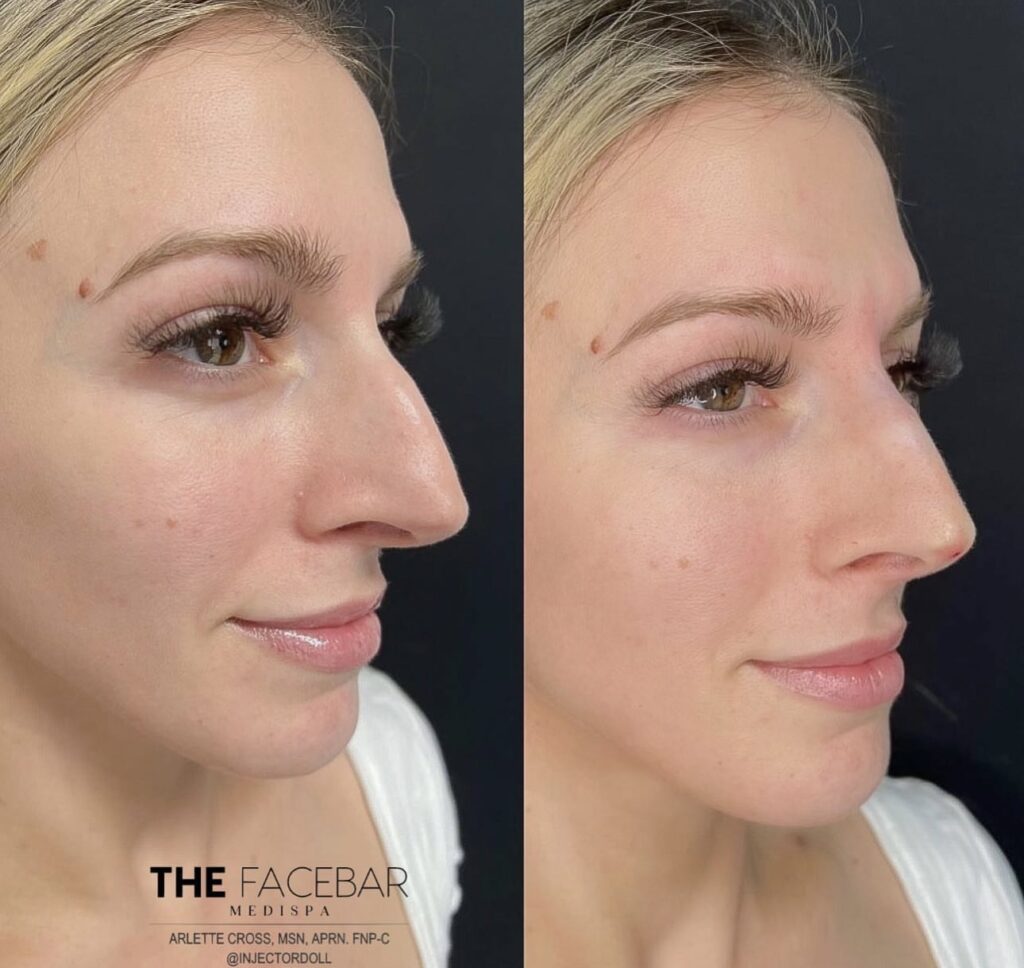 Results The Face Bar Aesthetic Medical DBA