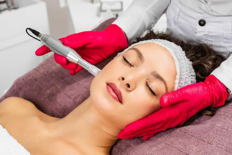 Microneedling with PRP in Pasadena, MD by The Face Bar Aesthetic Medicine