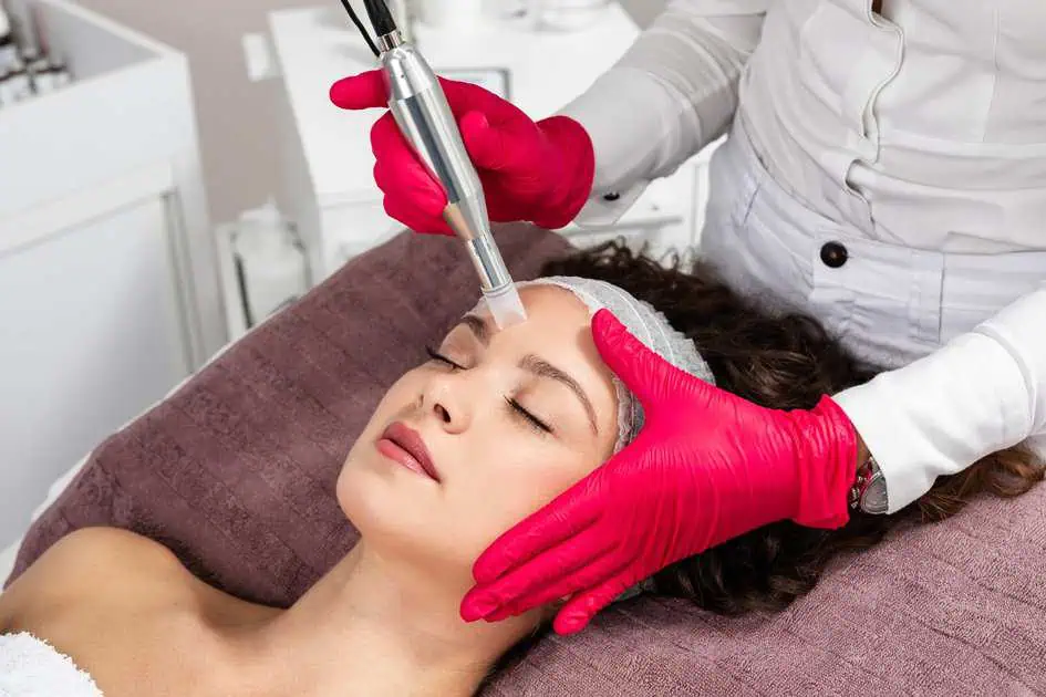 Skin Pen Microneedling In Pasadena, MD by The Facebar Aesthetic Medicine